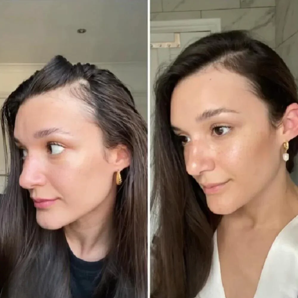 Vogany: il vostro olio naturale per la crescita dei capelli - immagine 4