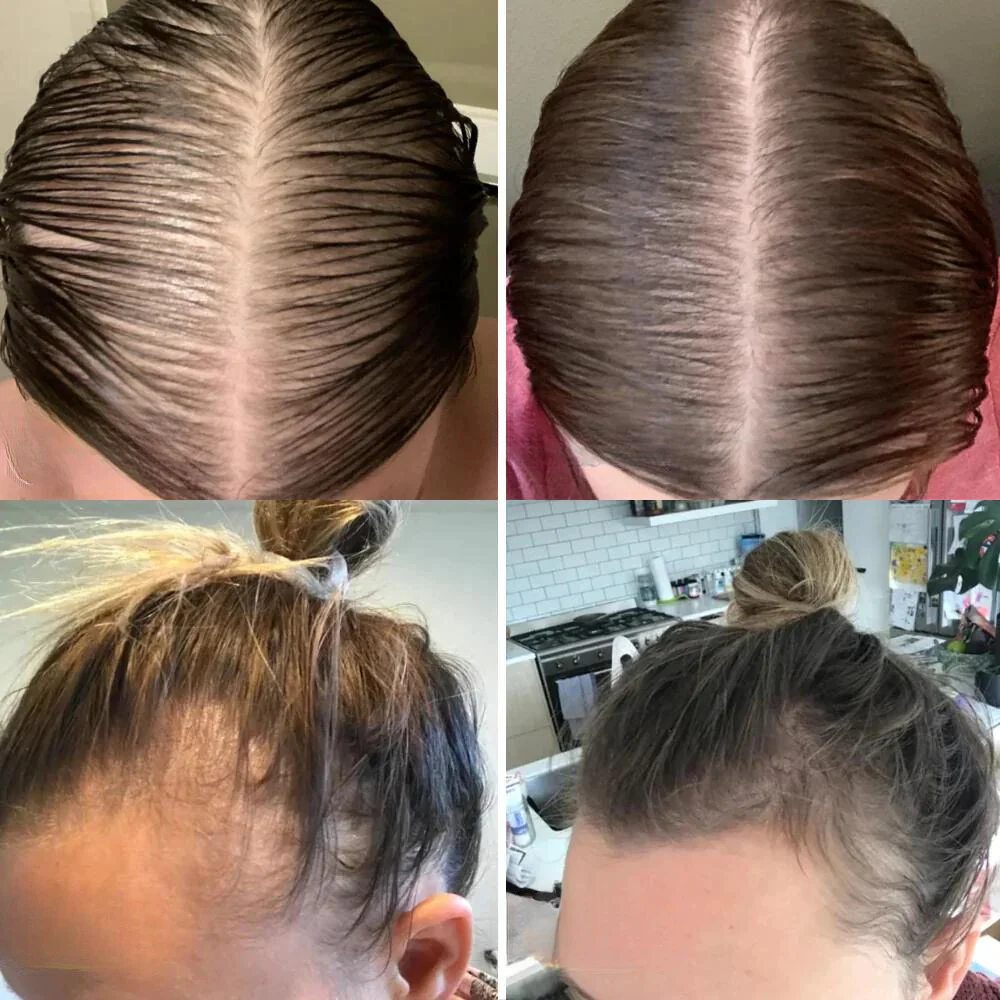 Vogany: il vostro olio naturale per la crescita dei capelli - immagine 6